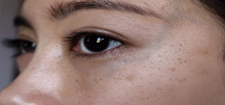 Tips Menghilangkan Flek Hitam dengan 7 Bahan Alami