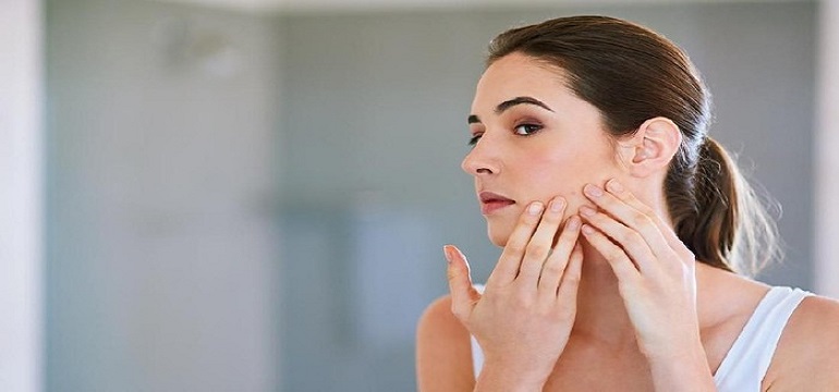 Obat Jerawat Tradisional yang Ampuh dan Aman bagi Kulit Wajah
